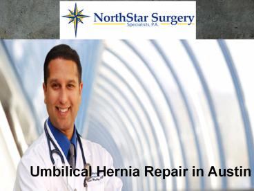 Symptoms and Procedure of Umbilical Hernia Repair