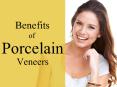 Benefits of Porcelain Veneers - Hillview Lewisham Dental Preactice PowerPoint PPT Presentation