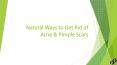Natural ways to get rid of acne & pimple scars PowerPoint PPT Presentation