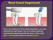 Root Canal Sugarland