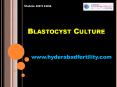 Top Blastocyst Culture Procedure by Hyderabad Fertility PowerPoint PPT Presentation