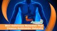 Best Gallstones Remedies That Cleanse Gallbladder Naturally PowerPoint PPT Presentation