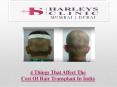 4 Things That Affect The Cost Of Hair Transplant In India PowerPoint PPT Presentation