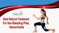 Best Natural Treatment For Non-Bleeding Piles, Hemorrhoids PowerPoint PPT Presentation
