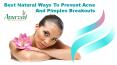 Best Natural Ways To Prevent Acne And Pimples Breakouts PowerPoint PPT Presentation