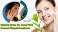 Natural Cures for Acne That Prevent Pimple Breakouts PowerPoint PPT Presentation