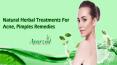 Natural Herbal Treatments For Acne, Pimples Remedies