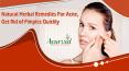 Natural Herbal Remedies For Acne, Get Rid of Pimples Quickly