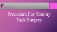 Procedure For Tummy Tuck Surgery PowerPoint PPT Presentation