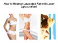 Choose A Liposuction Treatment to Obtain Fat Free Body PowerPoint PPT Presentation