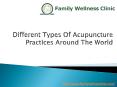 Different Types Of Acupuncture Practices Around The World PowerPoint PPT Presentation