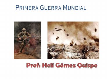 Primera Guerra Mundial