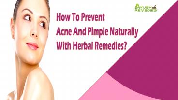 How To Prevent Acne And Pimple Naturally With Herbal Remedies?