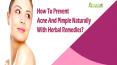 How To Prevent Acne And Pimple Naturally With Herbal Remedies?
