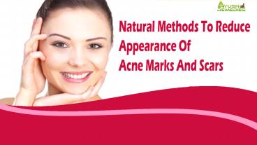 Natural Methods To Reduce Appearance Of Acne Marks And Scars