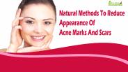 Natural Methods To Reduce Appearance Of Acne Marks And Scars