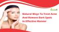 Natural Ways To Treat Acne And Remove Dark Spots In Effective Manner PowerPoint PPT Presentation