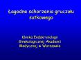Lagodne schorzenia gruczolu sutkowego PowerPoint PPT Presentation