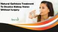Natural Gallstone Treatment To Dissolve Kidney Stones Without Surgery PowerPoint PPT Presentation