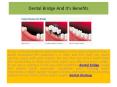 Dental Bridge And It's Benefits PowerPoint PPT Presentation