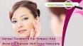 Herbal Treatment For Pimples And Acne To Improve Skin Glow Naturally