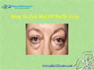 How to get rid of puffy eyes naturally