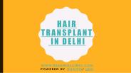 Hair Transplant in Delhi