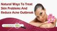 Natural Ways To Treat Skin Problems And Reduce Acne Outbreak PowerPoint PPT Presentation