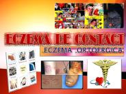 ECZEMA  ORTOERGICA