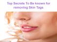 Top Secrets To Be known for removing Skin Tags PowerPoint PPT Presentation