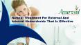 Natural Treatment For External And Internal Hemorrhoids That Is Effective PowerPoint PPT Presentation
