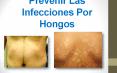 3 Consejos Para Prevenir Las Infecciones Por Hongos PowerPoint PPT Presentation