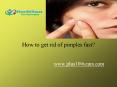 How to get rid of Pimples fast PowerPoint PPT Presentation