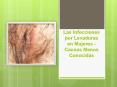 Las Infecciones por Levaduras en Mujeres - Causas Menos Conocidas PowerPoint PPT Presentation