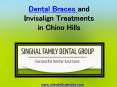 Dental Braces and Invisalign Treatments in Chino Hills PowerPoint PPT Presentation