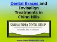 Dental Braces and Invisalign Treatments in Chino Hills (1) PowerPoint PPT Presentation