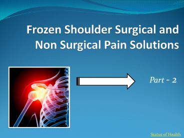 Frozen Shoulder Surgical and Non Surgical Pain Solutions (1)