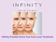Infinity Provides Stress Free Acne Laser Treatment