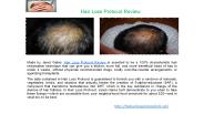 Hair Loss Protocol Review