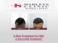 Is Hair Transplant For Men A Successful Treatment? PowerPoint PPT Presentation