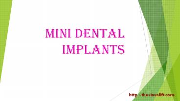 mini dental implants