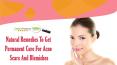 Natural Remedies To Get Permanent Cure For Acne Scars And Blemishes PowerPoint PPT Presentation