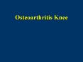 Osteoarthritis Knee PowerPoint PPT Presentation