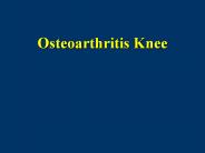 Osteoarthritis Knee