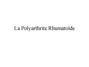 La Polyarthrite Rhumato