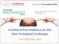 Get Rid of Your Baldness by This Hair Transplant Technique PowerPoint PPT Presentation