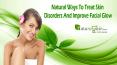 Natural Ways To Treat Skin Disorders And Improve Facial Glow PowerPoint PPT Presentation