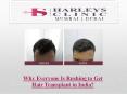 Why Everyone Is Rushing to Get Hair Transplants? PowerPoint PPT Presentation