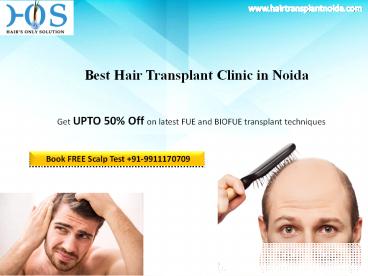 Hair transplant treatment at discounted rates Contact HOS 9911170709