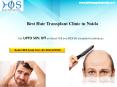Hair transplant treatment at discounted rates Contact HOS 9911170709